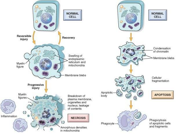 bagaimana sel kanser terbentuk